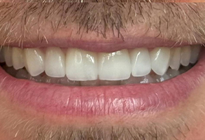 dentes 3